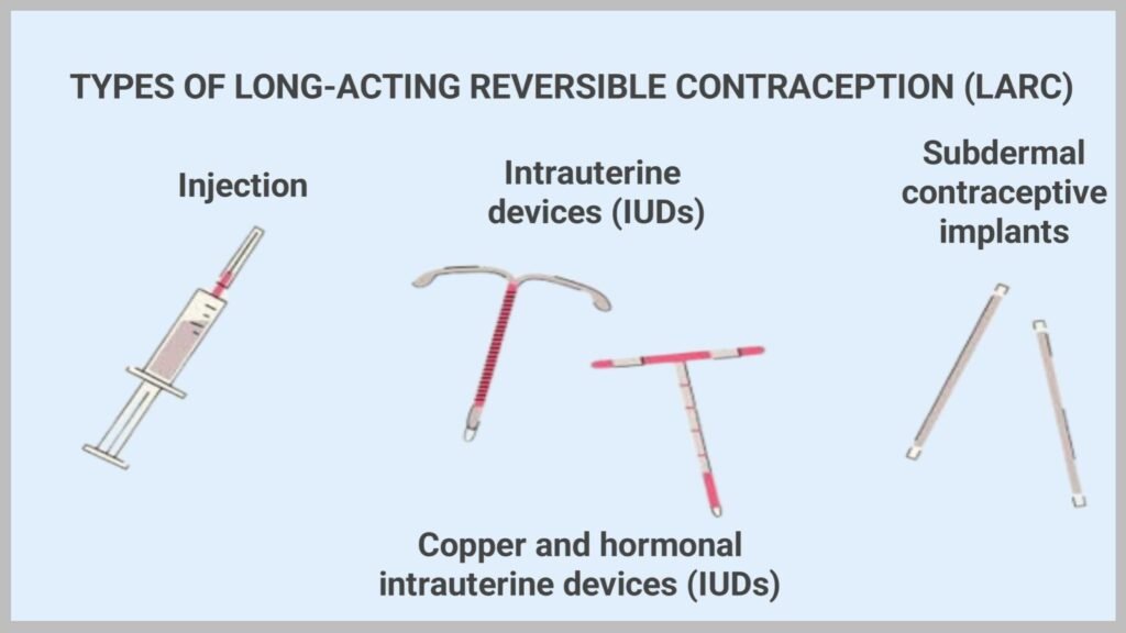 Long-Acting Reversible Contraception (LARC)